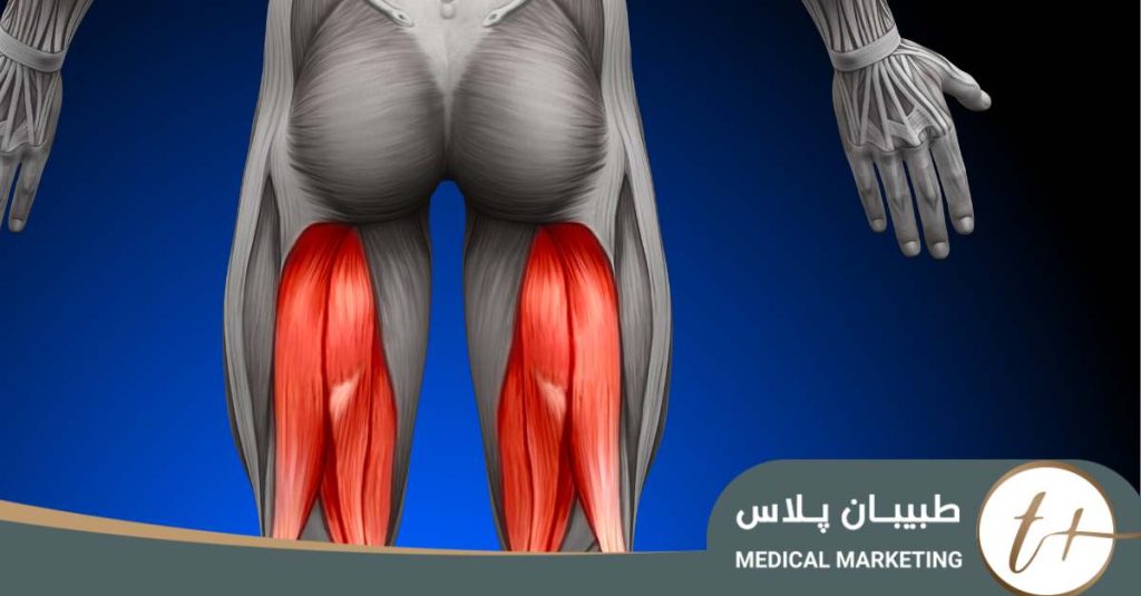 لیپوماتیک ران پا چیست آشنایی با جدیدترین روش درمان چربی ران پا